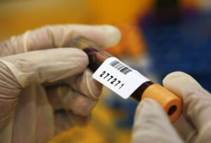 prostate cancer misdiagnosis